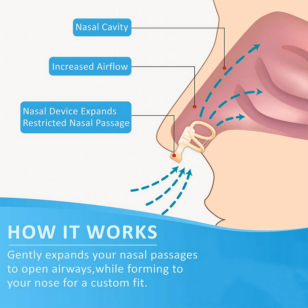 Anti Snore Nasal Dilator หยุดก - Anti Snore Contour Pillow บทวิจารณ์และราคา